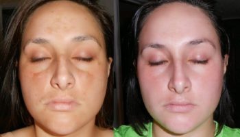 Tratamento pra um é diferente pra outro